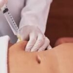 hidrolipoclasia